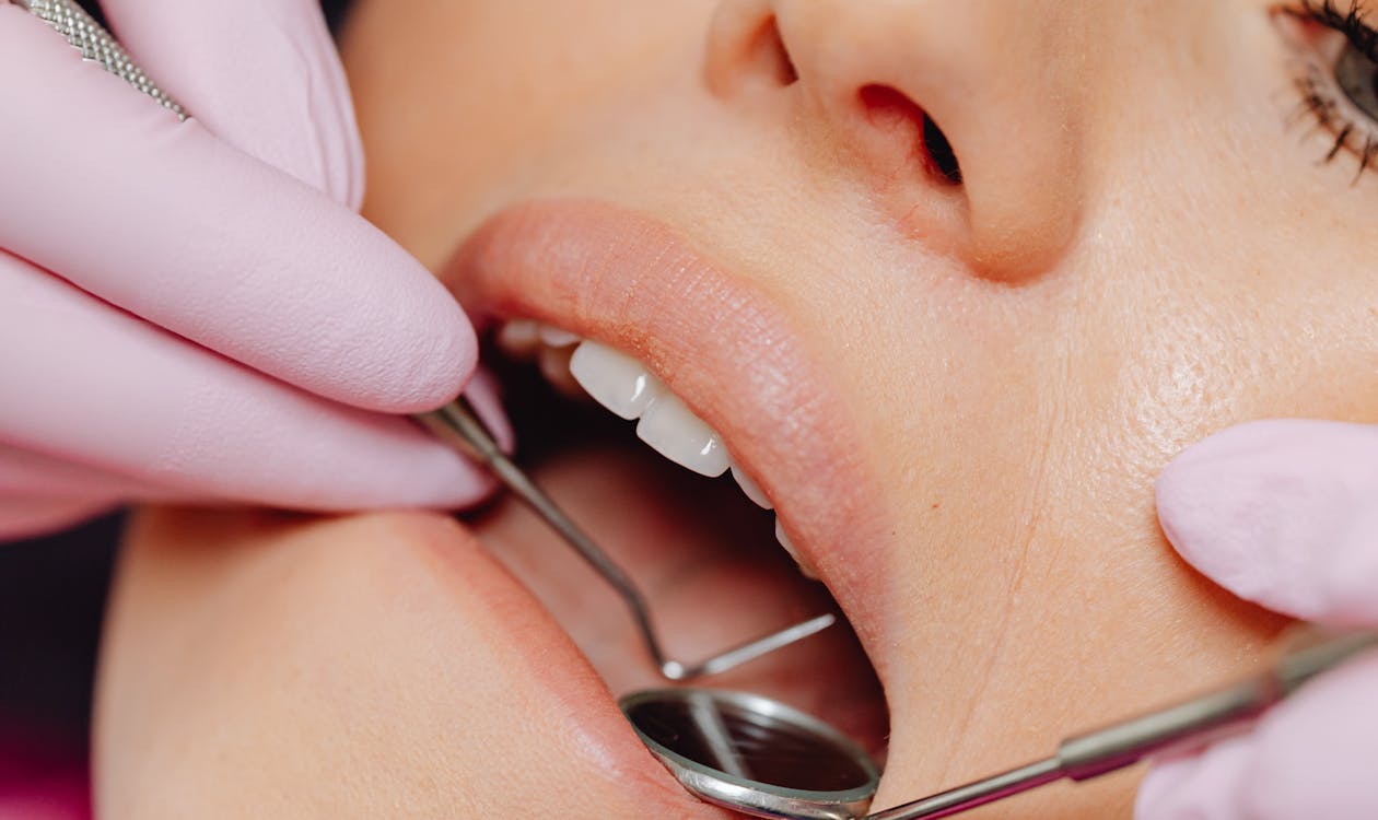 Soft Tissue Grafts at Hill Top Dental Group