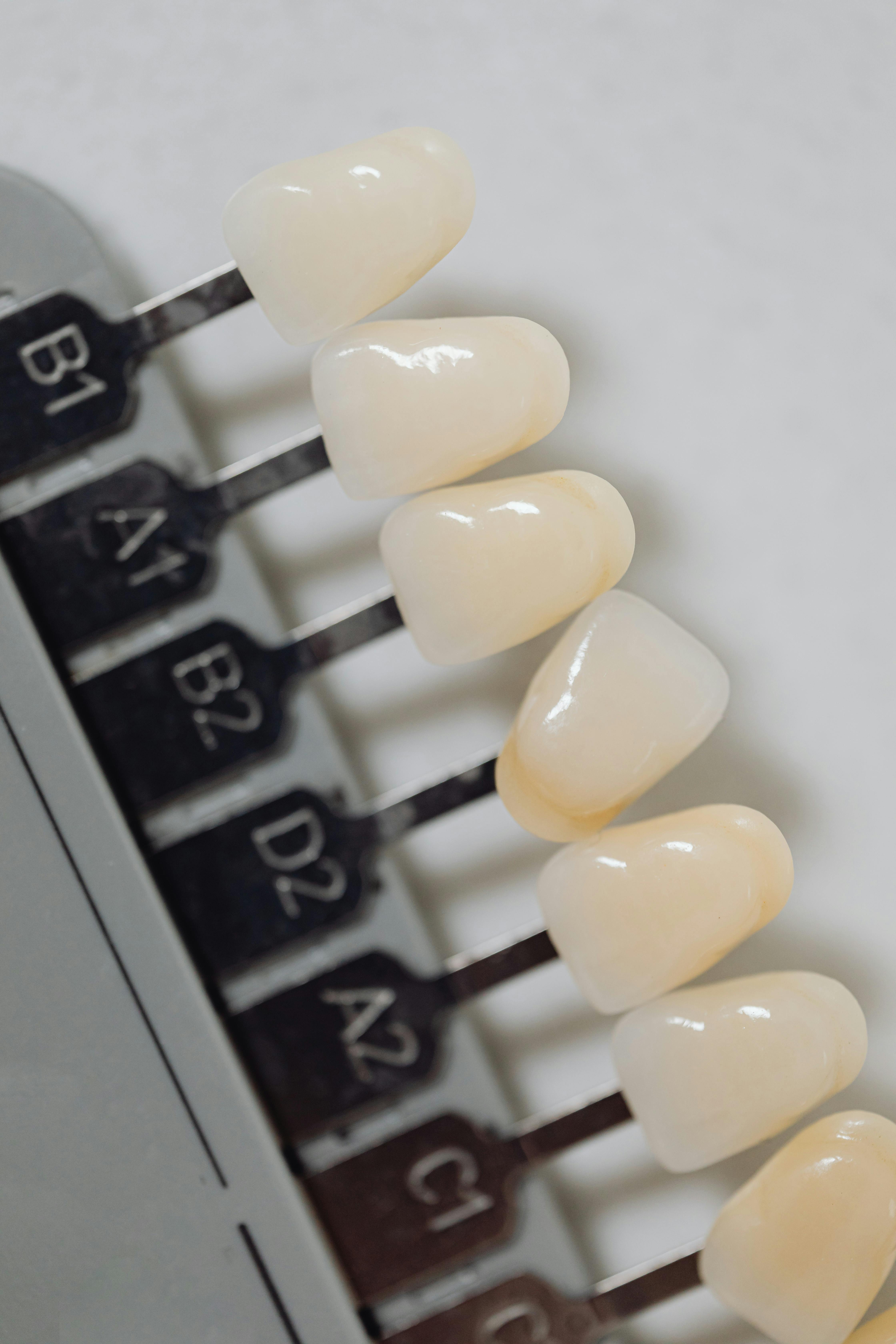Inlays & Onlays at Hill Top Dental Group
